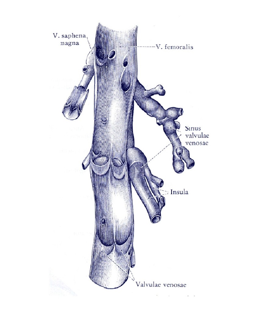 Boli ale venelor (varice si tromboflebite)